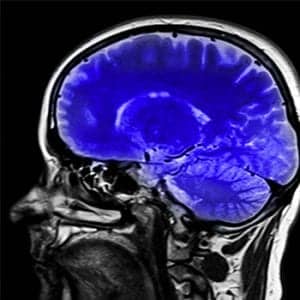 cranial nerves mnemonic feature image