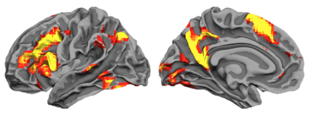 Brain scan of strong memory to illustrate how memory improvement and the Magnetic Memory Method Masterclass helps learners